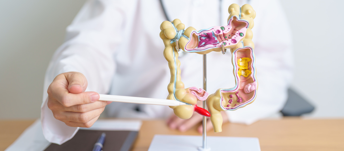 Wrzodziejące Zapalenie Jelita Grubego: Częste Objawy i Skutki - Radamed