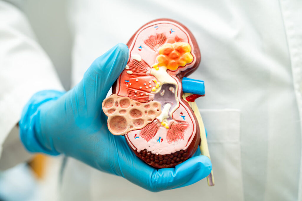 Co to jest niewydolność nerek i jak skutecznie leczyć chorobę?