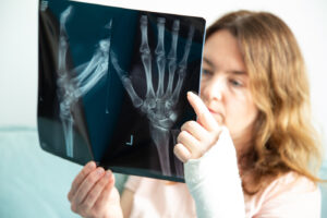 Złamania Kości: Typy, Objawy, i Metody Leczenia