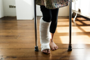 Złamanie Nogi: Typy, Objawy, Leczenie i Rehabilitacja