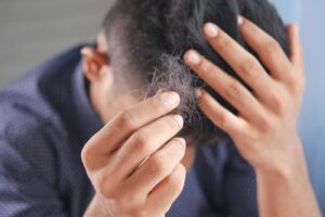 Wypadanie Włosów: Przyczyny, Objawy i Metody Leczenia